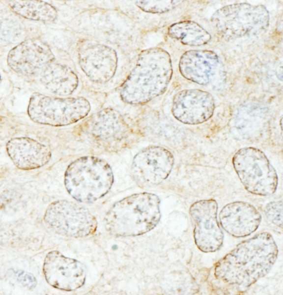 NUP50 Antibody (aa225-275)