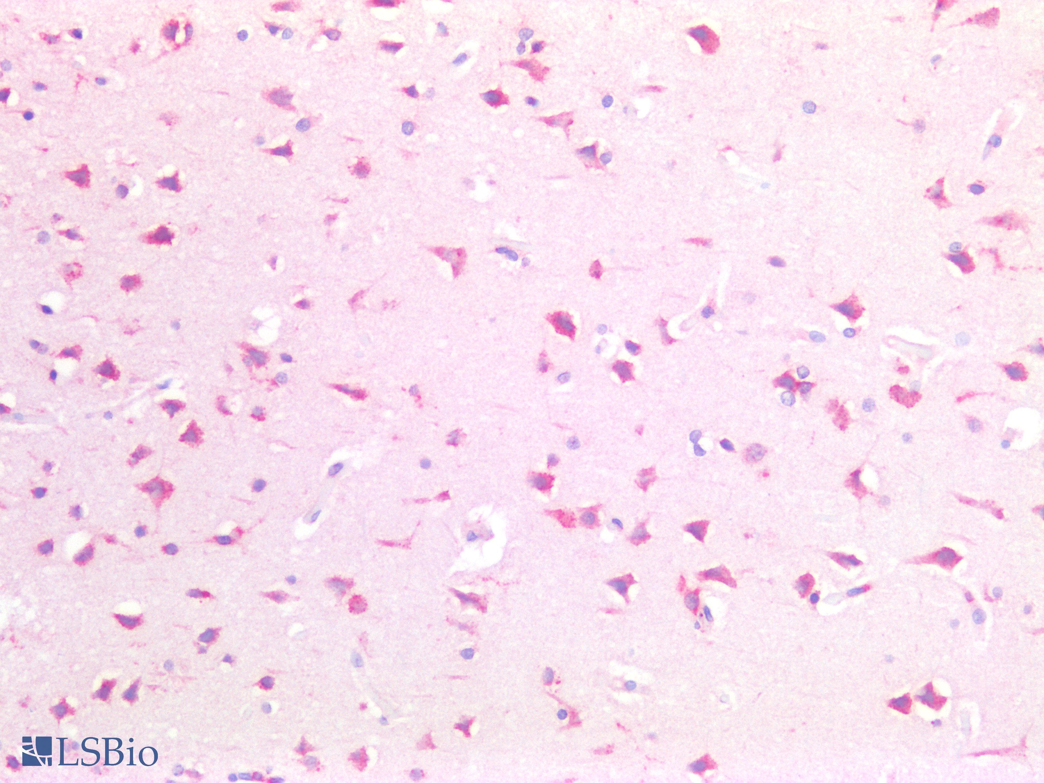 PathPlus™ TNRC5 / CNPY3 Antibody