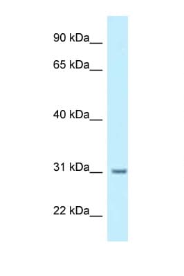 MCNAA / BPHL Antibody (aa34-83)