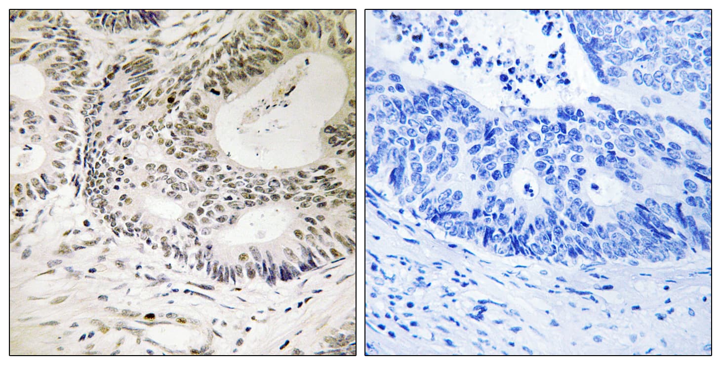 TP53BP1 / 53BP1 Antibody (phospho-Ser25)