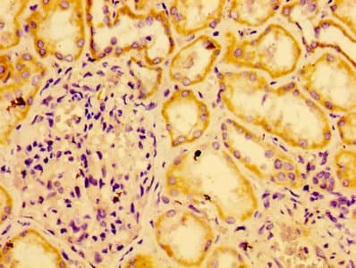 AGO2 / EIF2C2 Antibody (aa517-818)