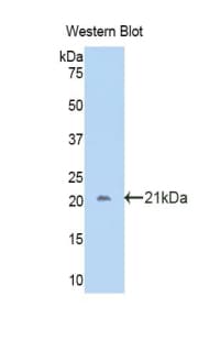 CA12 / Carbonic Anhydrase XII Antibody (aa161-318)