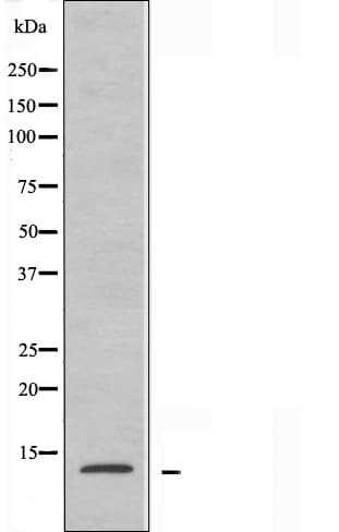 Polyclonal Rabbit anti-Human RPL30 / Ribosomal Protein L30 Antibody (IHC, IF, WB)