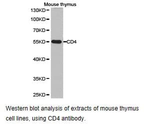 Polyclonal Rabbit anti-Human CCT2 / CCT Beta Antibody (IHC, WB)