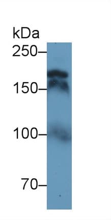 DNA Topoisomerase II Antibody (aa923-1148)