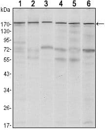 Monoclonal Mouse anti-Human ESET / SETDB1 Antibody (clone 5H6D4, WB)