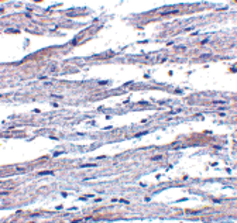 DDX58 / RIG-1 / RIG-I Antibody
