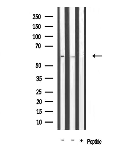 Polyclonal Rabbit anti-Human TRAF3IP3 Antibody (IF, WB)