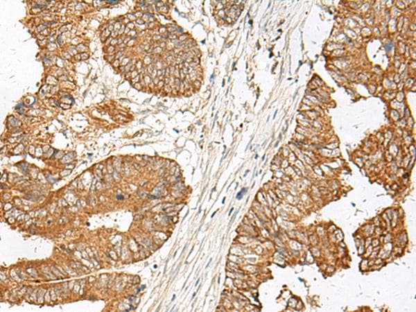 Polyclonal Rabbit anti-Human GNAT1 Antibody (IHC, WB)