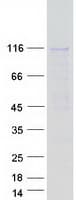 Human PPP6R2 / SAPS2 Protein (Recombinant Myc-DDK (Flag))