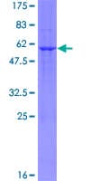 Human BCAP31 / BAP31 Protein (Recombinant GST)