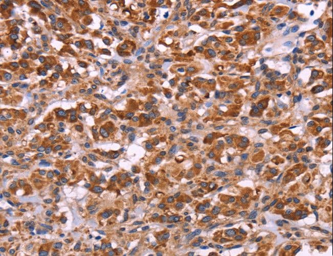 MMP14 Antibody