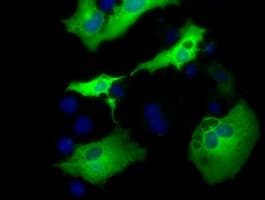 Monoclonal Mouse anti-Human AK5 / Adenylate Kinase 5 Antibody (clone OTI1D6, IF, WB)
