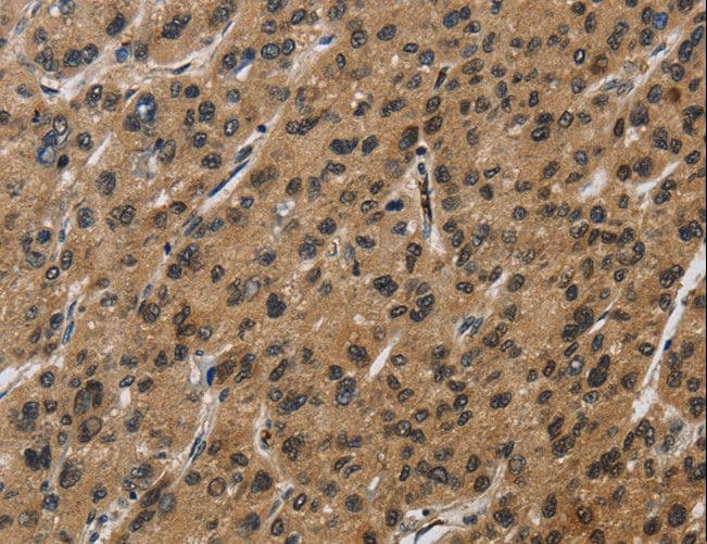 SYN1 / Synapsin 1 Antibody