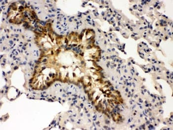 GRK5 Antibody
