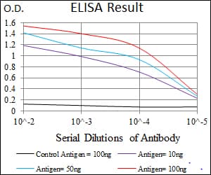 Monoclonal Mouse anti-Human ACLY / ATP Citrate Lyase Antibody (clone 5F8D11, IHC, IF, WB)