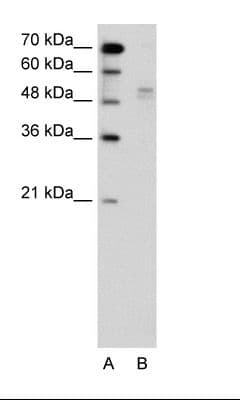 WWP2 Antibody (N-Terminus)
