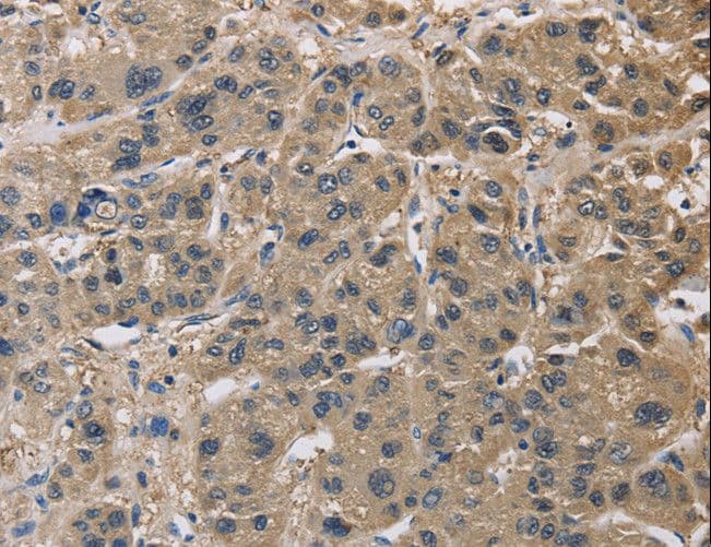 IMPDH1 Antibody