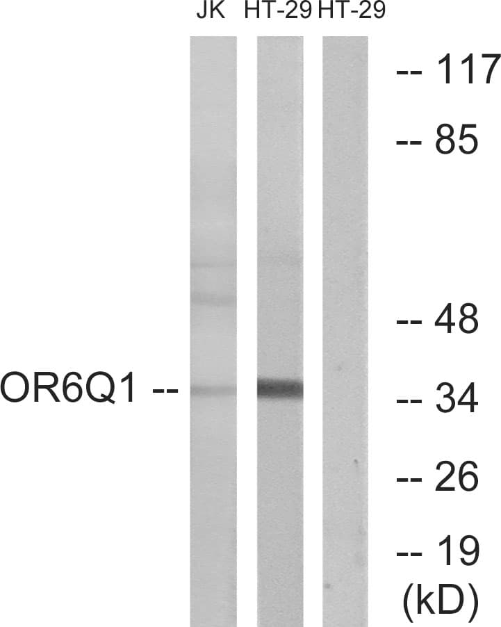 Polyclonal Rabbit anti-Human OR6Q1 Antibody (aa23-72, WB)
