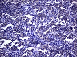 DOCK8 Antibody (aa84-405, clone OTI12D7)