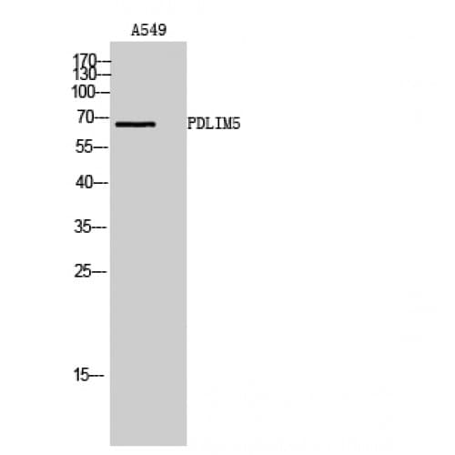 Polyclonal Rabbit anti-Human PDLIM5 / LIM Antibody (WB)