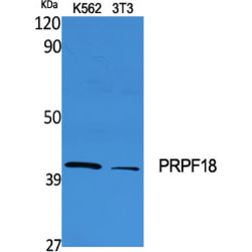 PRPF18 Antibody (160-240 aa, Internal)