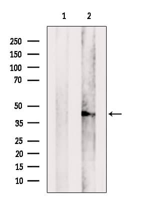 Polyclonal Rabbit anti-Human CCDC44 / TACO1 Antibody (IF, WB)
