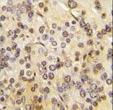 MEN1 / Menin Antibody (Thr594)