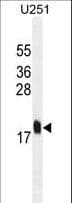 Monoclonal Mouse anti-Human MCFD2 Antibody (WB)