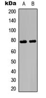 Polyclonal Rabbit anti-Human Ezrin + Radixin + Moesin Antibody (phospho-Thr567/Thr564/Thr558, IHC, IF, WB)