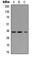 IHC-plus™ Polyclonal Rabbit anti-Human IRF1 / MAR Antibody (Internal, IHC, WB)