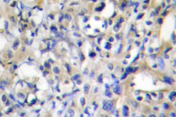 Polyclonal Rabbit anti-Human F2 / Prothrombin / Thrombin Antibody (Gly724, IHC, IF, WB)