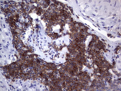 Monoclonal Mouse anti-Human TFPI2 Antibody (clone OTI1D4, aa23-235, IHC, WB)