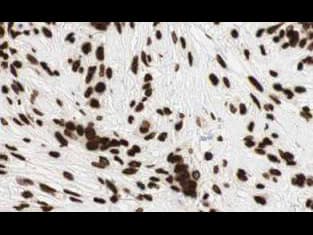 Polyclonal Rabbit anti-Human GLI2 Antibody (IHC, WB)