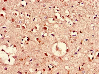 PIM3 / PIM-3 Antibody
