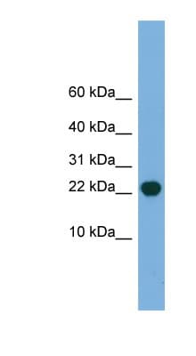 HSPC004 / POP5 Antibody (C-Terminus)
