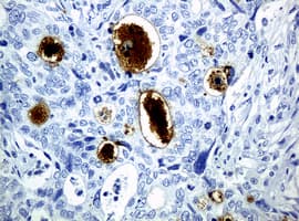 WFDC2 / HE4 Antibody (clone OTI1B9)
