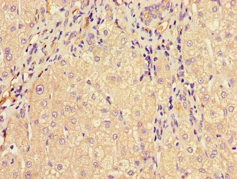 MTTP / MTP Antibody