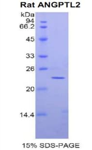 Rat ANGPTL2 / ARP2 Protein (Recombinant His)