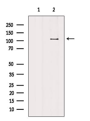 Polyclonal Rabbit anti-Human AP2B1 Antibody (WB)