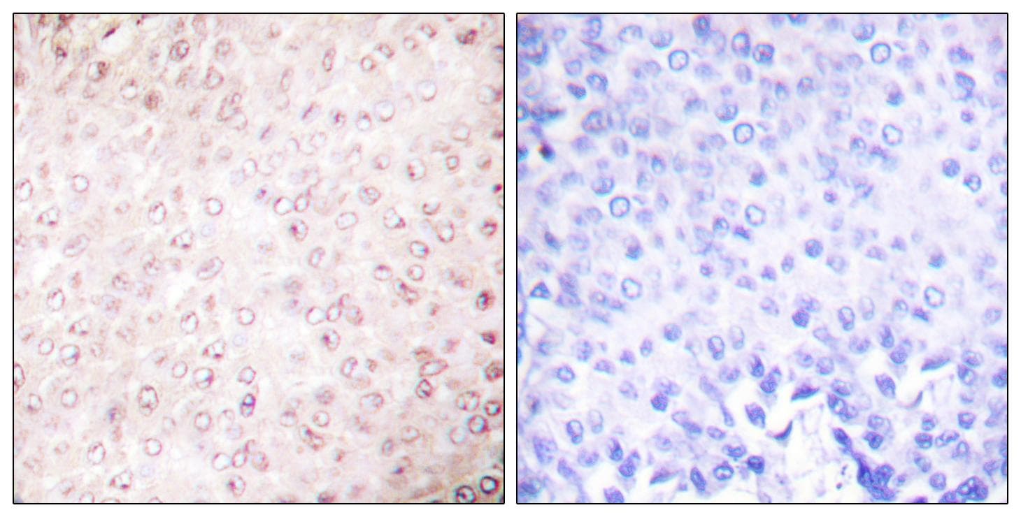 KAT2B / PCAF Antibody