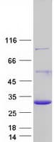 Human DGCR6 Protein (Recombinant Myc-DDK (Flag))