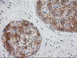 BAIAP2 / IRSP53 Antibody (clone OTI 1D9)