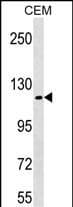 c-Kit / CD117 Antibody (Tyr721)