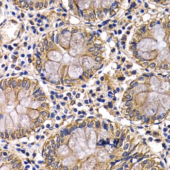 Polyclonal Rabbit anti-Human ARRB2 / Beta Arrestin 2 Antibody (IHC, IF, WB)