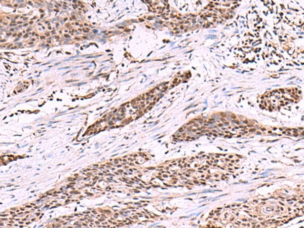 Cullin 4A / CUL4A Antibody