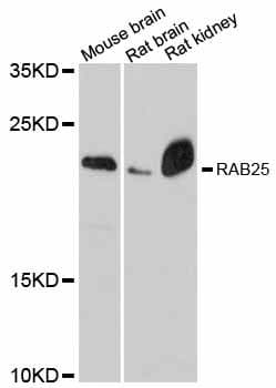 Polyclonal Rabbit anti-Human RAB25 Antibody (WB)