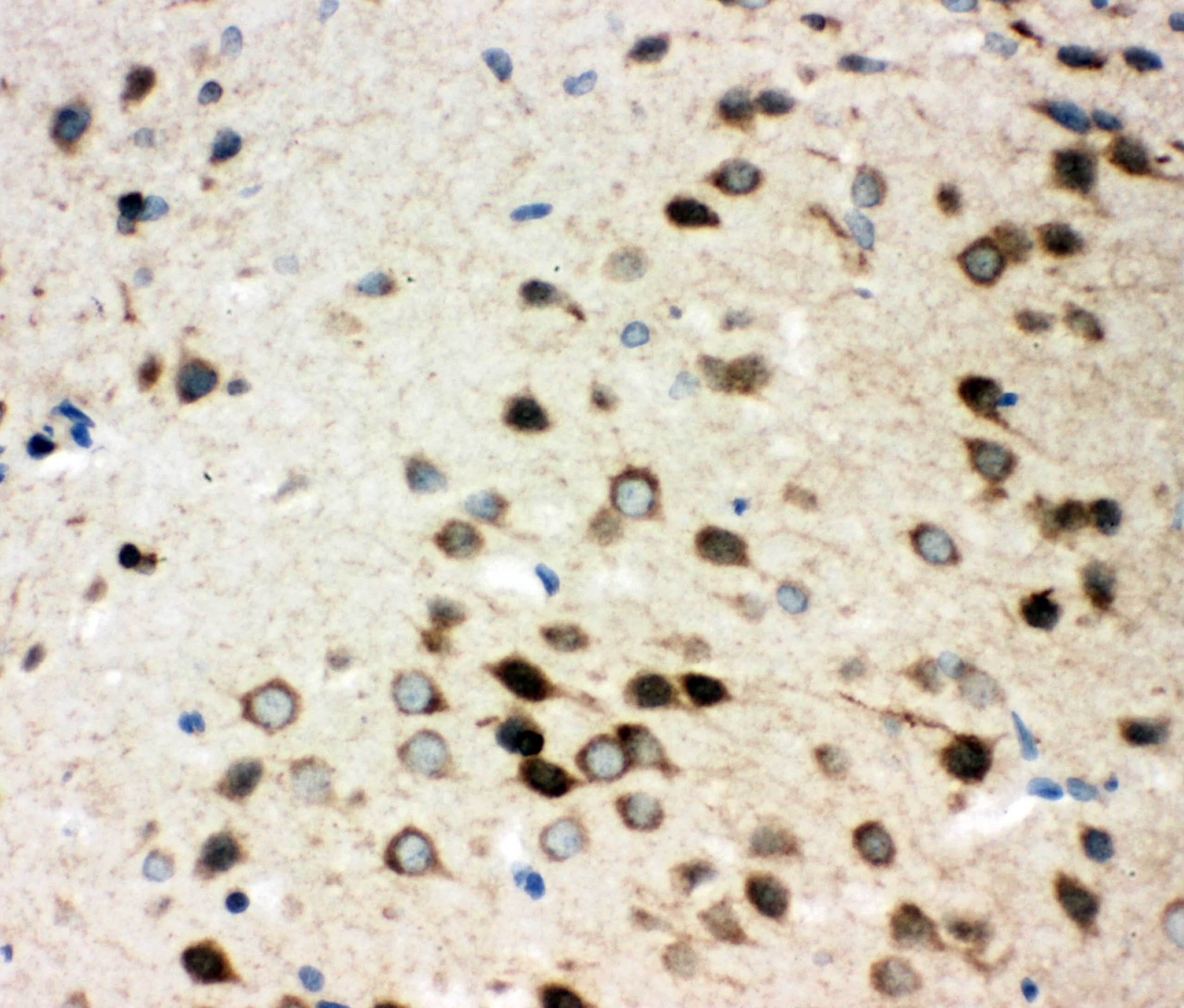 ITGA3 / CD49c Antibody (aa51-67)