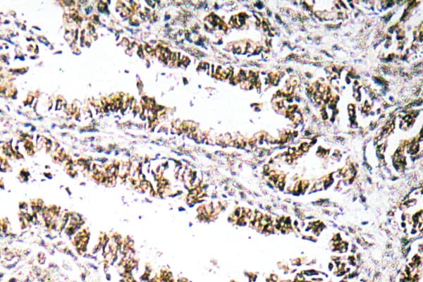 Polyclonal Rabbit anti-Human STEAP1 / STEAP Antibody (aa31-80, IHC, WB)