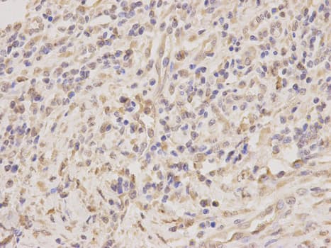 TRAIL-R4 / DCR2 Antibody